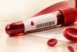 Hemoglobin Report